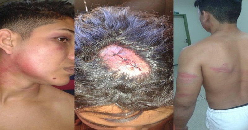 Jovem acusa PMs de espancamento no AC: ‘bateram muito em mim’