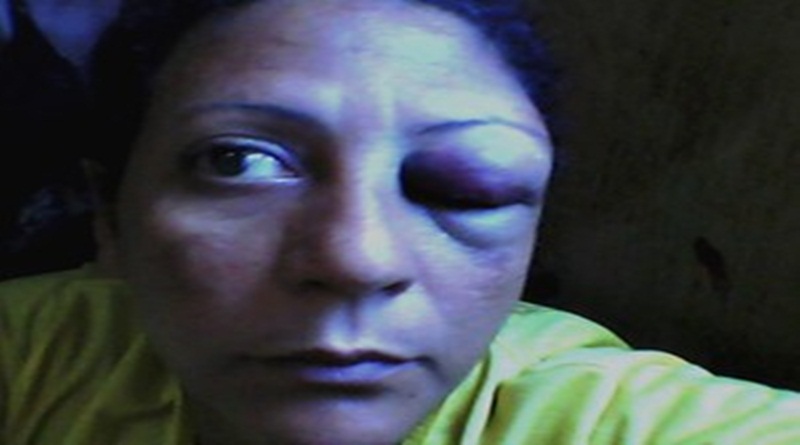 Jornalista é preso após dar soco em mulher e diz: ‘barraqueira merece’