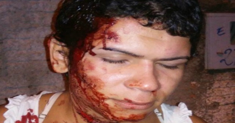 Transexual é agredida com cabo de vassoura