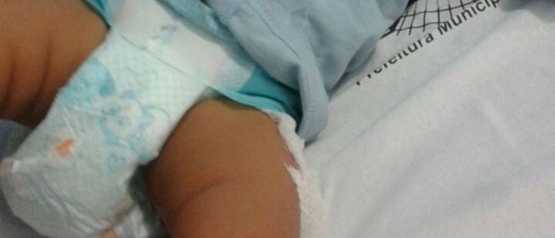 Mulher é presa após queimar perna da filha de 7 meses em Rondônia