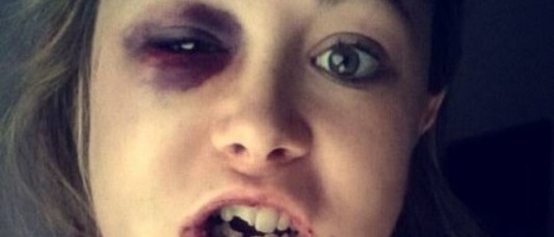 Jovem agredida por negar sexo posta alerta nas redes sociais