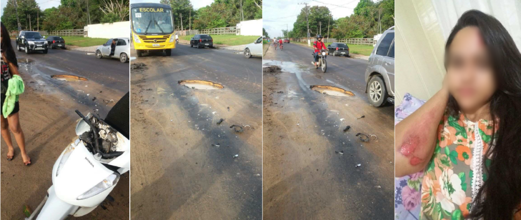 Motociclista cai em buraco e processa Prefeitura de Ilderlei Cordeiro