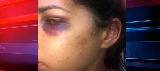 Agressão contra a mulher cresce de forma assustadora em Sena