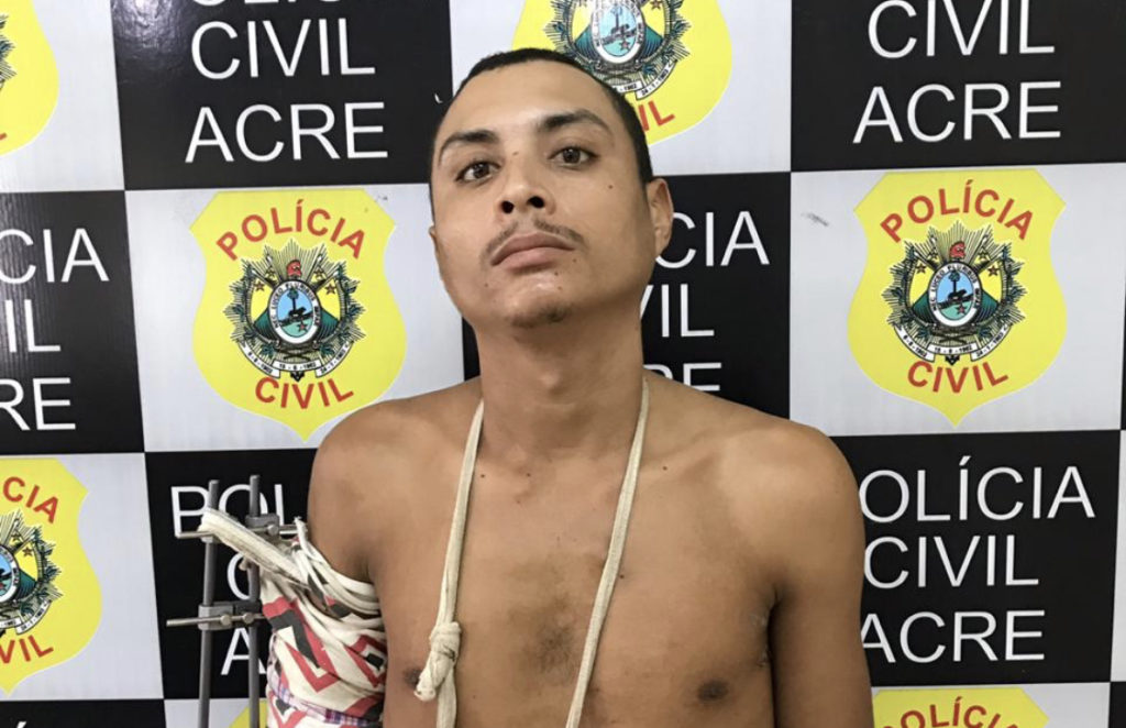 Suspeito de assalto baleado pela PM é recapturado após fugir de hospital no interior do Acre