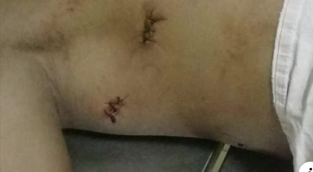 Estudante é atingido com 5 facadas dentro de escola em Sena Madureira