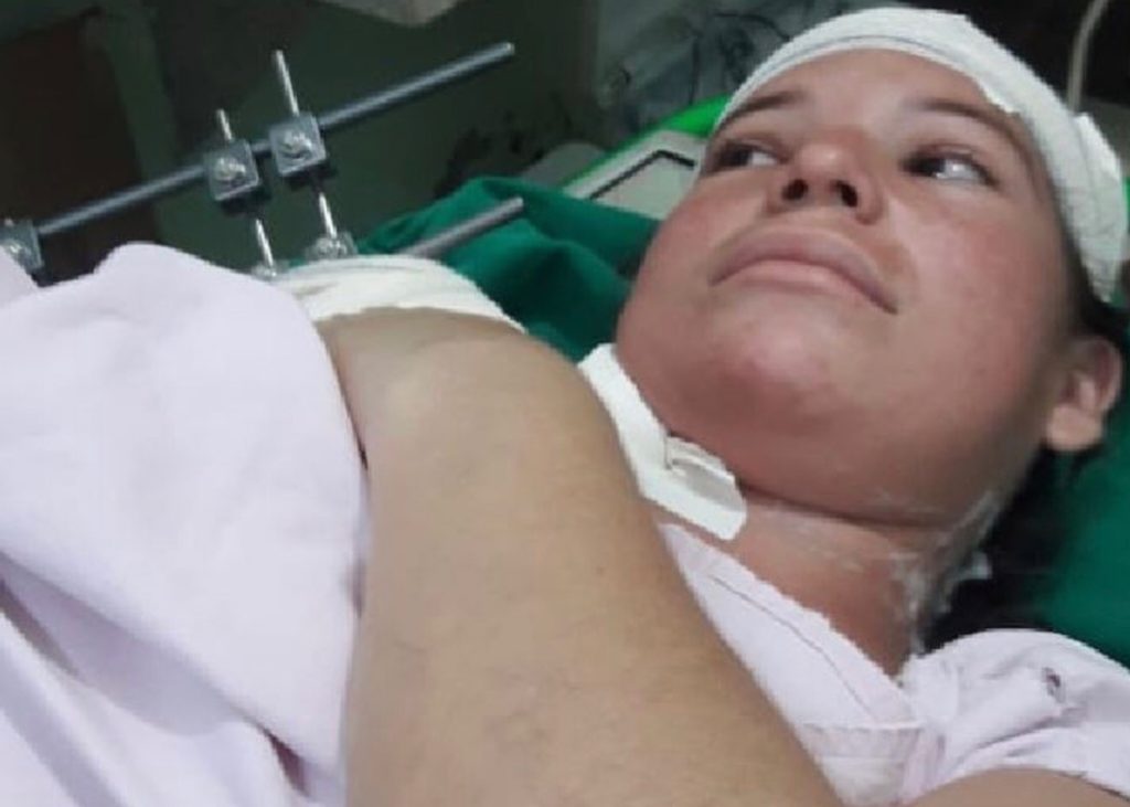 Mulher que perdeu bebê após agressão do amante aguarda cirurgia na perna