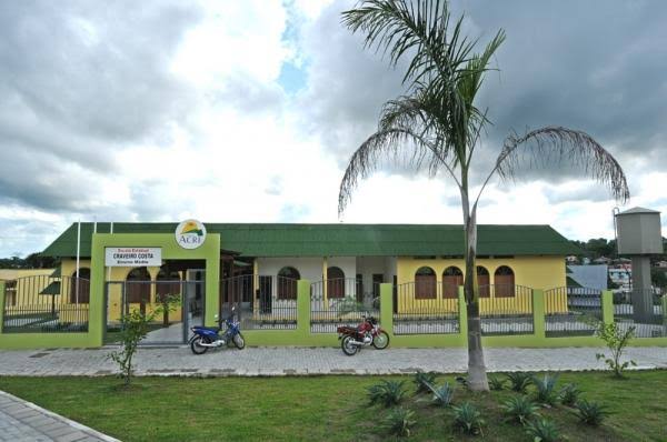 Crescem o número casos de caxumba nas escolas de Cruzeiro do Sul