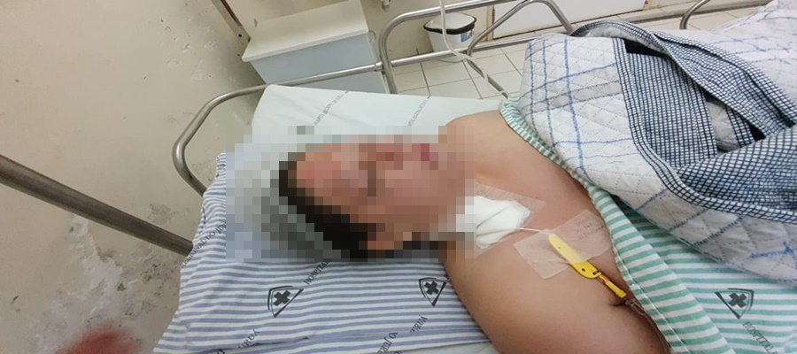 Jovem com 45% do corpo queimado aguarda liberação da Gol para viajar a tratamento