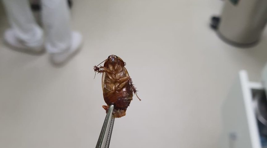 Na Capital, médico retira barata viva do ouvido de paciente que chegou desesperada na Unimed