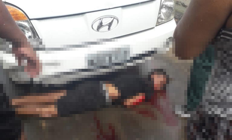 Após se envolver em acidente, jovem morre no Hospital do Juruá