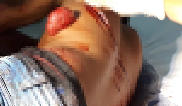 Tarauacá: açougueiro reage a assalto e esfaqueia assaltante