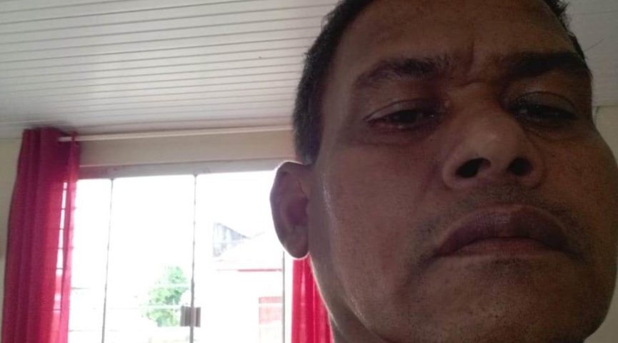 No Acre, motoqueiro é atingido no pescoço por linha de cerol