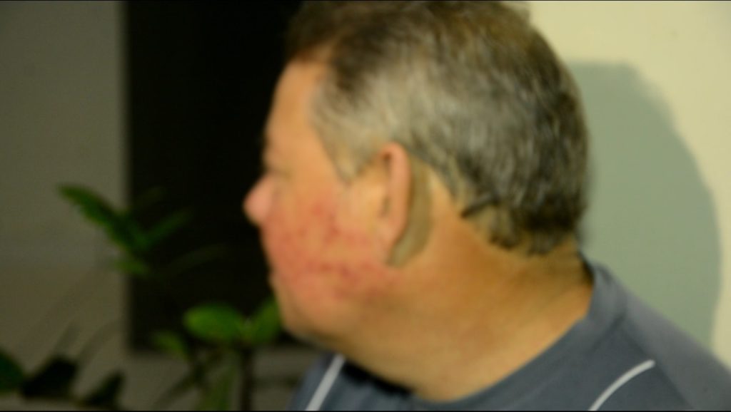 Empresário sequestrado em Rio Branco foi queimado com cigarros e levou coronhadas na cabeça