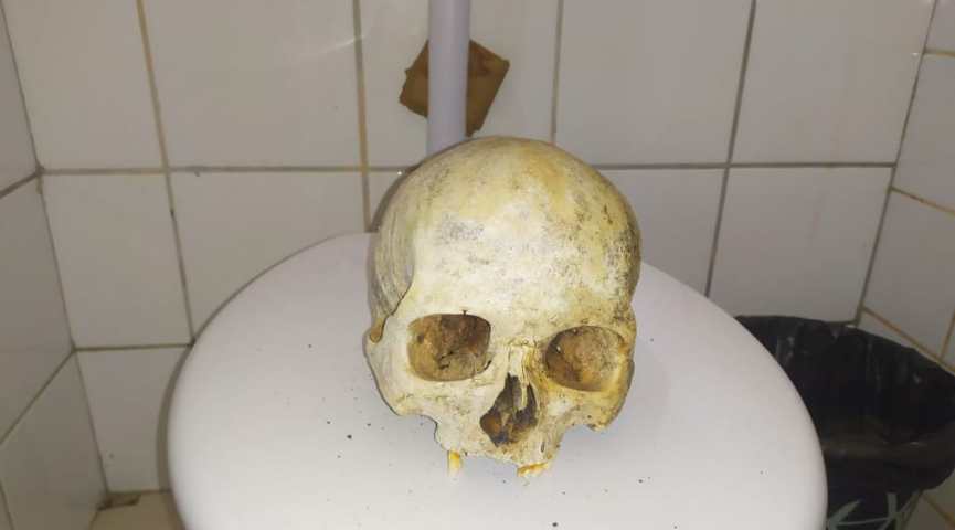 Estudante leva crânio humano para escola em Rio Branco e assusta alunos e funcionários