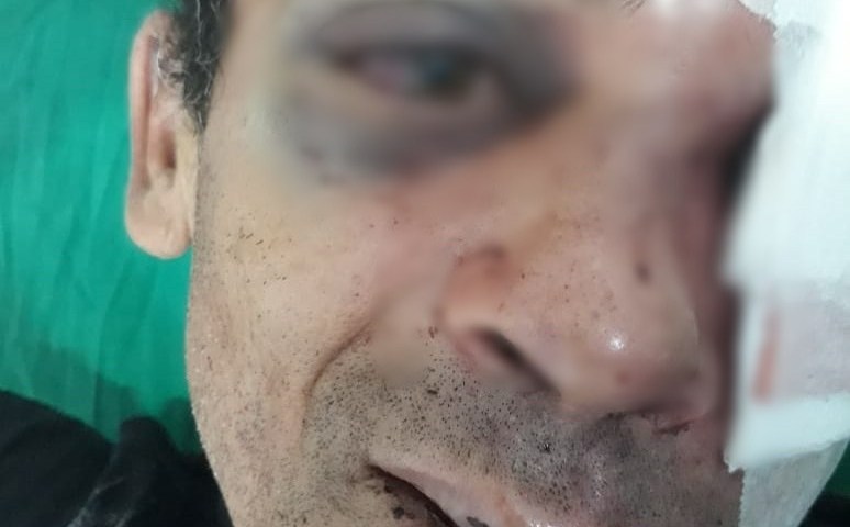 No Acre, pai recebe paulada e é espancado por filho com transtorno mental