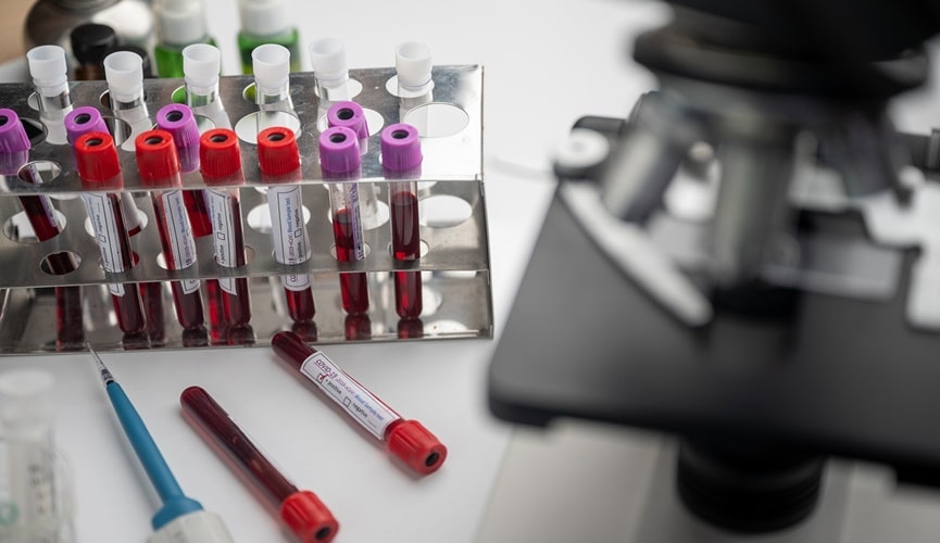 Pesquisadores da USP começam a testar vacina contra Covid-19