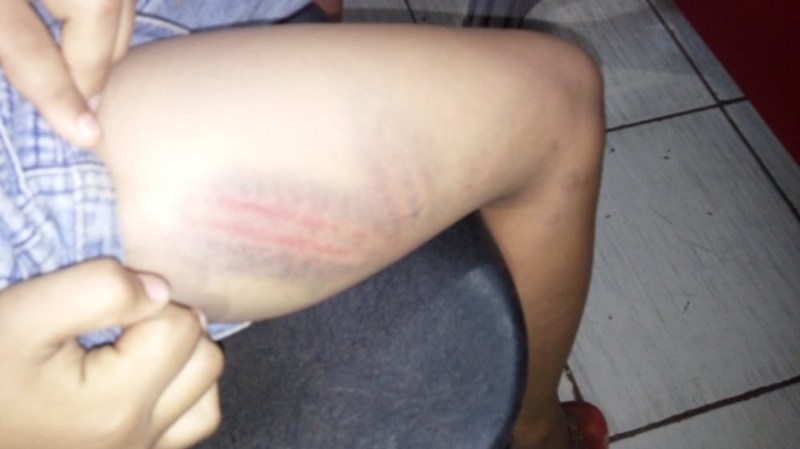 Mãe é presa após surrar a filha de 13 anos com fio de chapinha por ter saído de casa