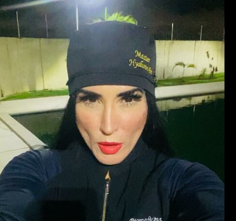 Acreana se destaca em clínica com especialização em camuflagem de estrias