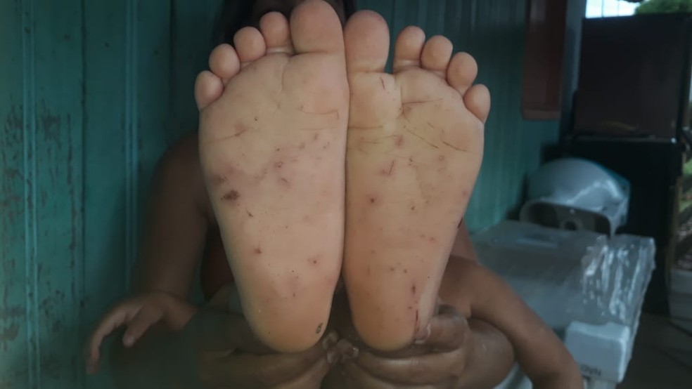 Pai é procurado por agredir filho de 3 anos com cipó e furar os pés da criança no interior do Acre