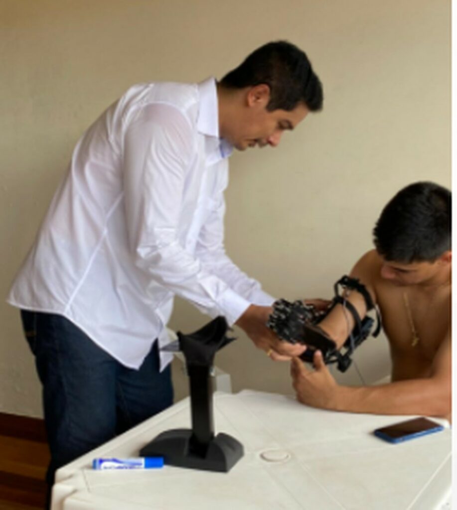 Fisioterapeuta do AC cria braço robótico usando manequim para ajudar amigo amputado