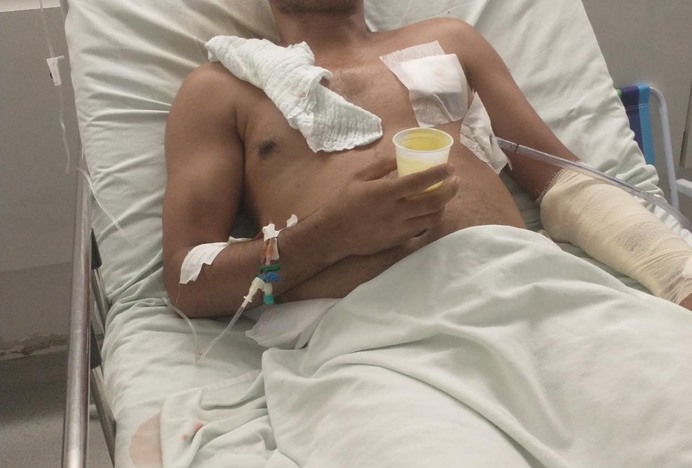 Após quase uma semana, secretário que reagiu a assalto e matou suspeito se recupera em hospital em Rio Branco e tem quadro estável