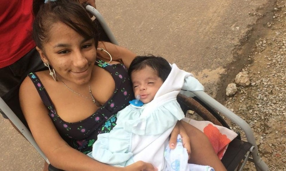 Bebê com ‘ossos de vidro’ morre aos 11 meses após parada cardíaca no Acre