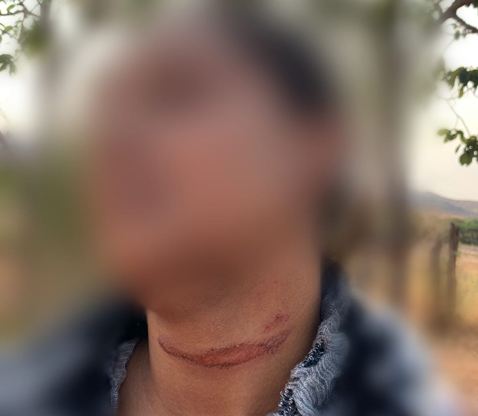 Vereador é preso após amarrar esposa em árvore e arrastá-la por terreno em MG: ‘Me solta, não me mata não’