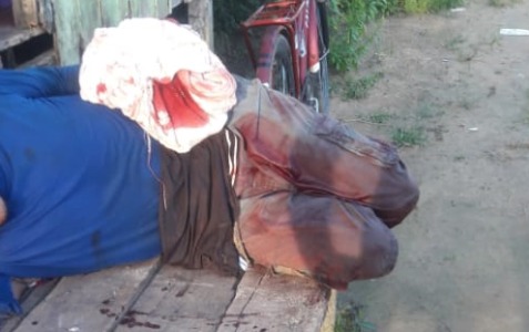 Homem tem mão decepada durante bebedeira em Cruzeiro do Sul