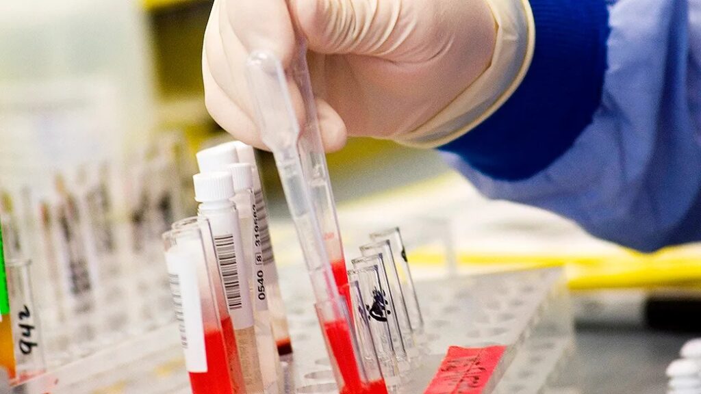 No Acre, diabéticos passam a ter atendimento prioritário na hora de fazer exames que necessitem de jejum