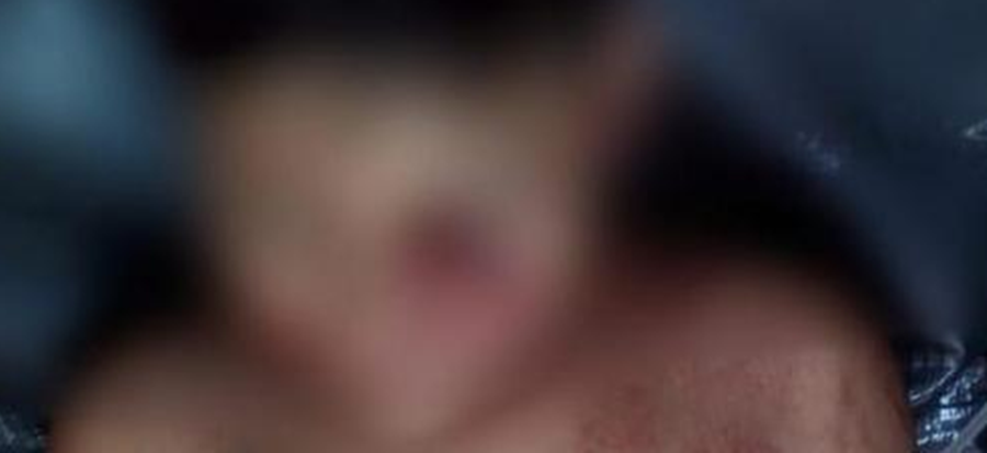 No Acre, criança de 8 anos é atacada por trio de pitbulls e vai parar no PS