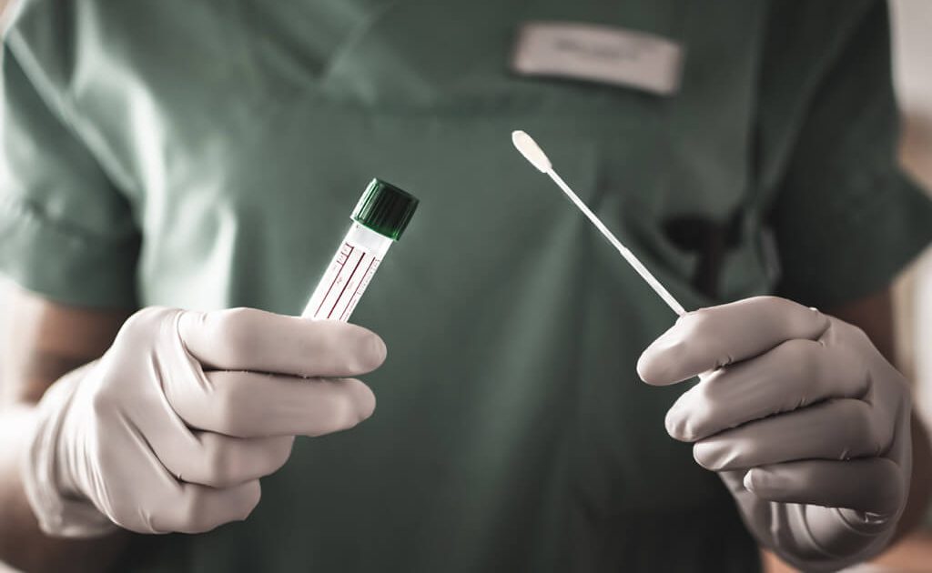 Em 24 horas, Acre soma quase 40 novos casos de Covid-19, informa Sesacre