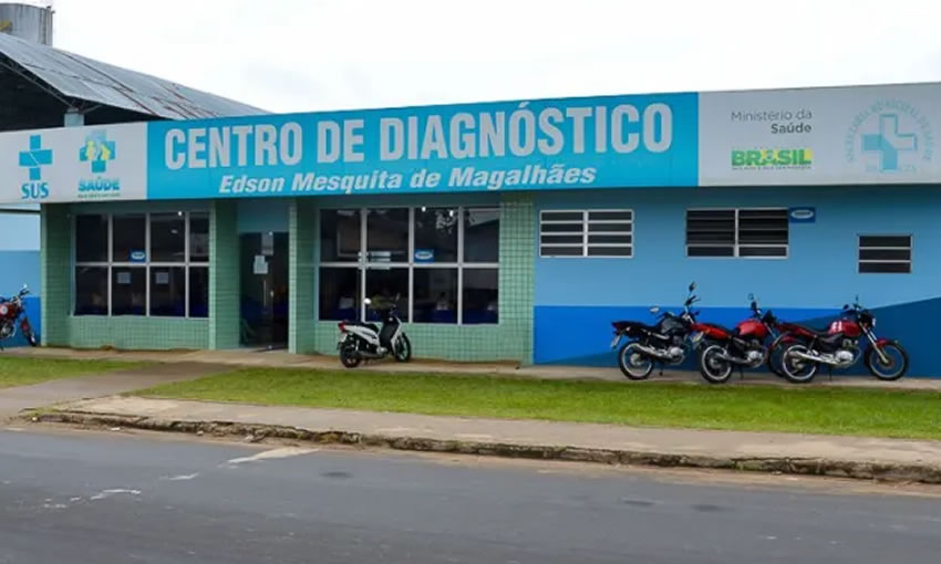 Com 15 servidores com Covid, laboratório de Cruzeiro do Sul passa a atender apenas exames de urgência