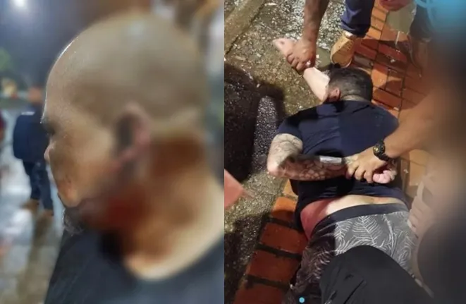 Homem arranca parte da orelha de segurança ao ser expulso de casa noturna