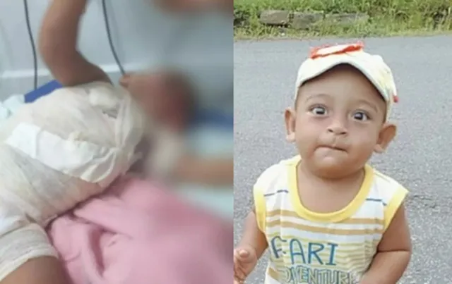 Bebê de 1 ano é internado na UTI com queimaduras após puxar panela de água quente de cima do fogão