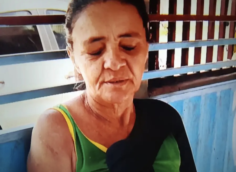 Paciente que esperava cirurgia há 6 anos tem procedimento suspenso por falta de pinos