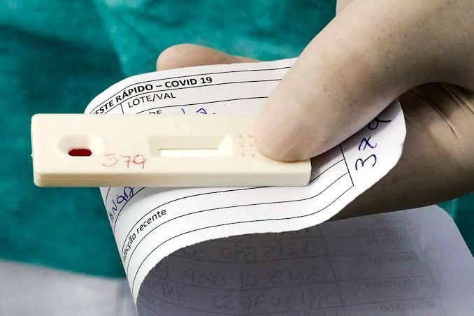 Acre registra apenas 11 novos casos de Covid-19 nesta segunda-feira