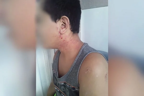 Mãe de autista denuncia clínica por negligência: “Morderam meu filho”