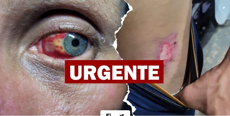 Peão é espancado por faccionados e escapa da morte após chegada da polícia