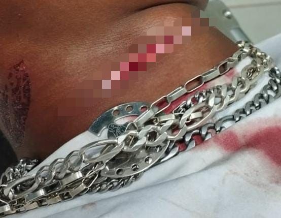 Jovem quase é degolado após furto de perfumes no interior do Acre