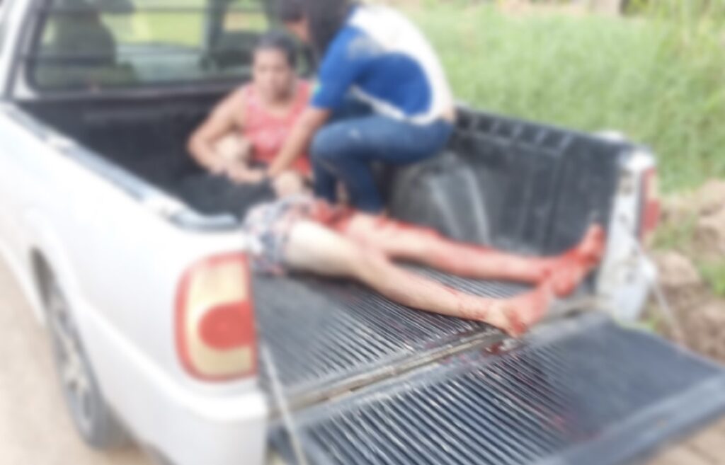 Tragédia em Marechal Thaumaturgo: Jovem perde a vida após acidente com faca