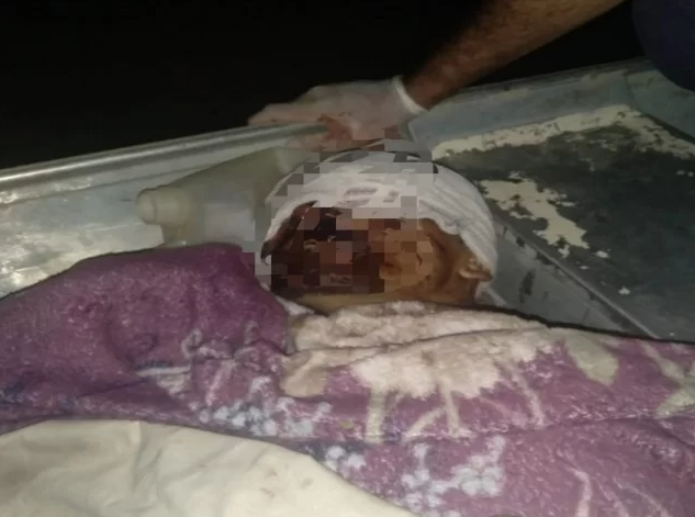 Homem é alvejado com tiro na cabeça na zona rural de Mâncio Lima