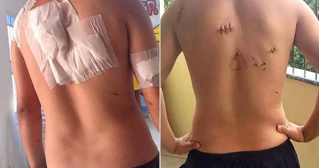 Homem esfaqueado em tentativa de assalto em Rio Branco sobrevive: ‘Deus me ama’