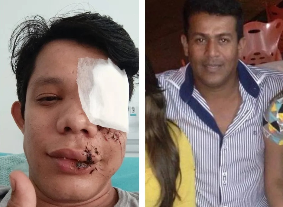 Professor que perdeu o olho após ser agredido por empresário desabafa: ‘me deu marcas para o resto da vida’