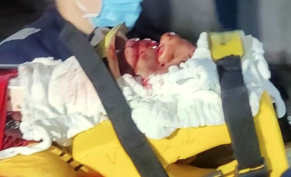 Ciclista colide na traseira de caminhão carregado de toras na BR-364