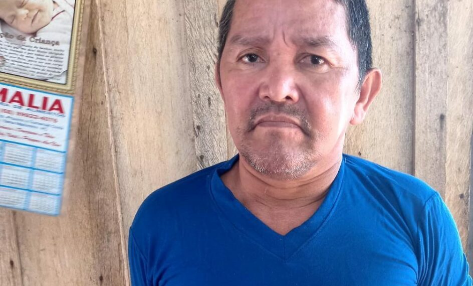 Acreano sofre AVC, fica com sequelas e mãe pede ajuda para custear cirurgia