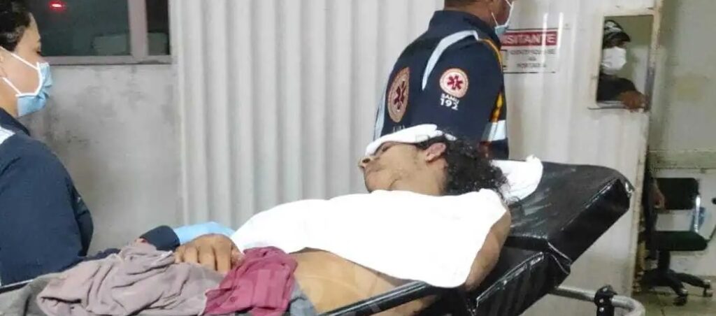 Homem em situação de rua tem afundamento de crânio após ser espancado com ripa e garrafa