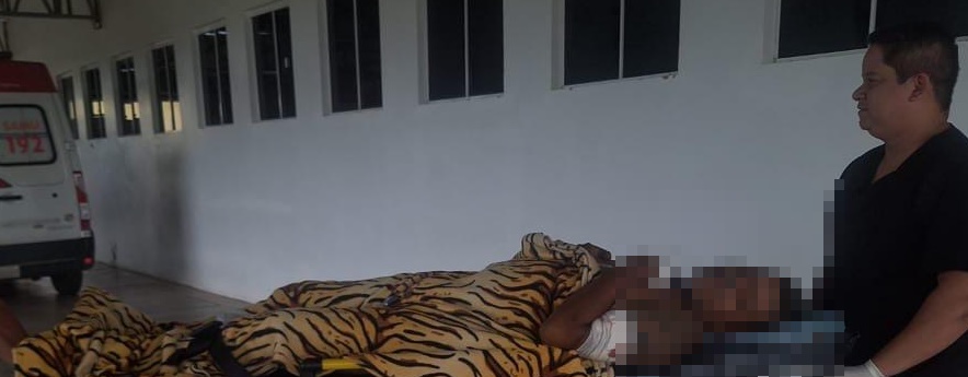 Jovem sofre tentativa de homicídio enquanto participava de festa no interior do Acre
