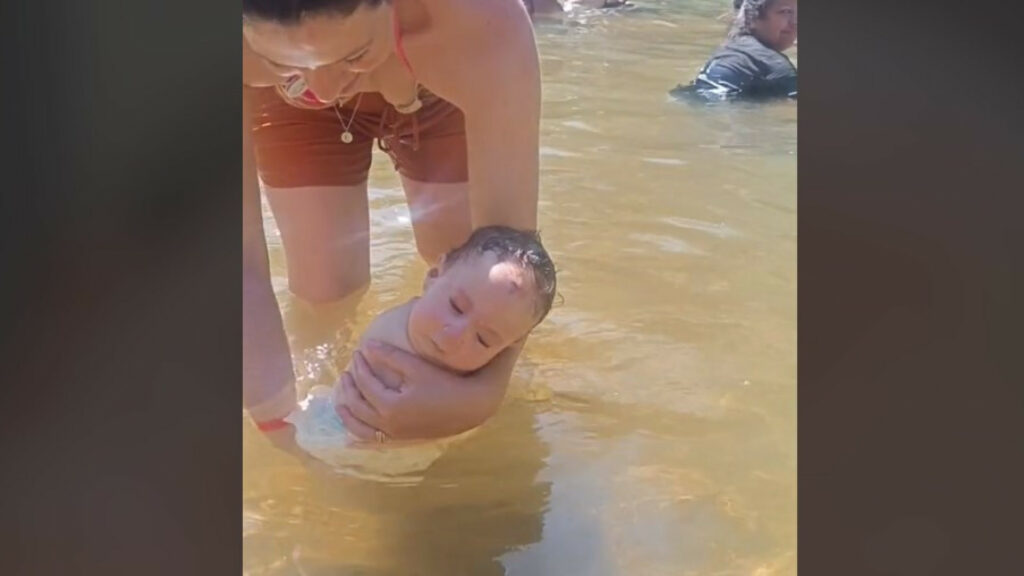 Bebê brasileira com doença rara emociona internet; menina nasceu sem pernas e braços