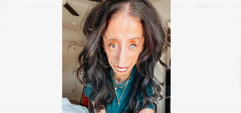 Mulher tachada como a ‘mais feia do mundo’ transforma bullying em inspiração global