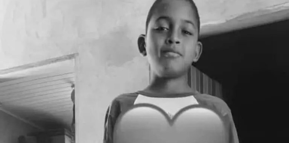 Criança de 13 anos sofre AVC hemorrágico e morre na UTI em Rio Branco